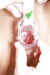 Brincalhão Morena cuutie no copos vai através de alguns incomum ginecomastia procedimentos